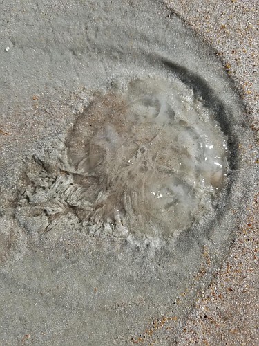 More than 100 people reported jellyfish stings on Saturday, June 9. Photo courtesy of Volusia County Beach Safety Ocean Rescue