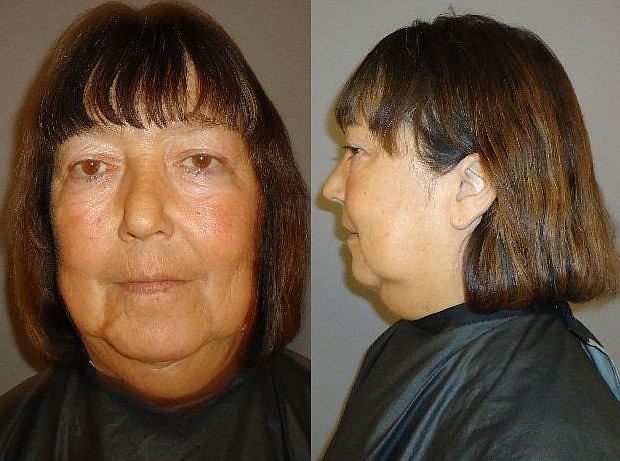 Jamesine Fischer, 55, surrendered herself at 7 p.m. Feb. 24.
