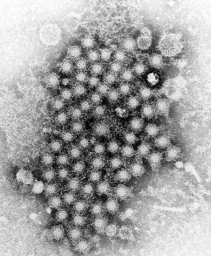Hepatitis A virus. Courtesy image