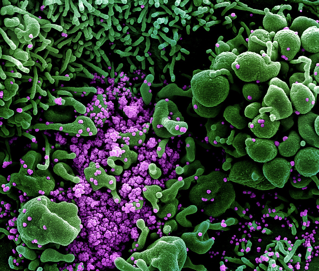 A scanning electron micrograph of an cell (green) infected with SARS-COV-2 virus particles (purple). Image by NIAID.