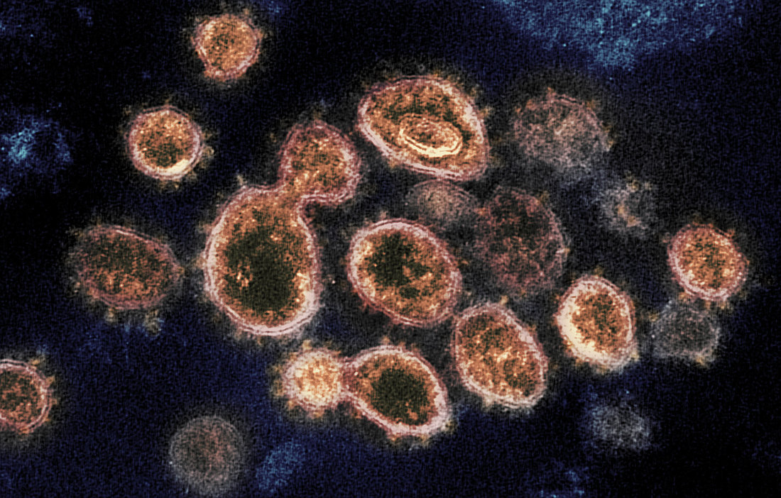 A transmission electron microscope image of COVID-19 from a U.S. patient. Image by the NIH National Institute of Allergy and Infectious Diseases. See more at https://bit.ly/2IO4feI.