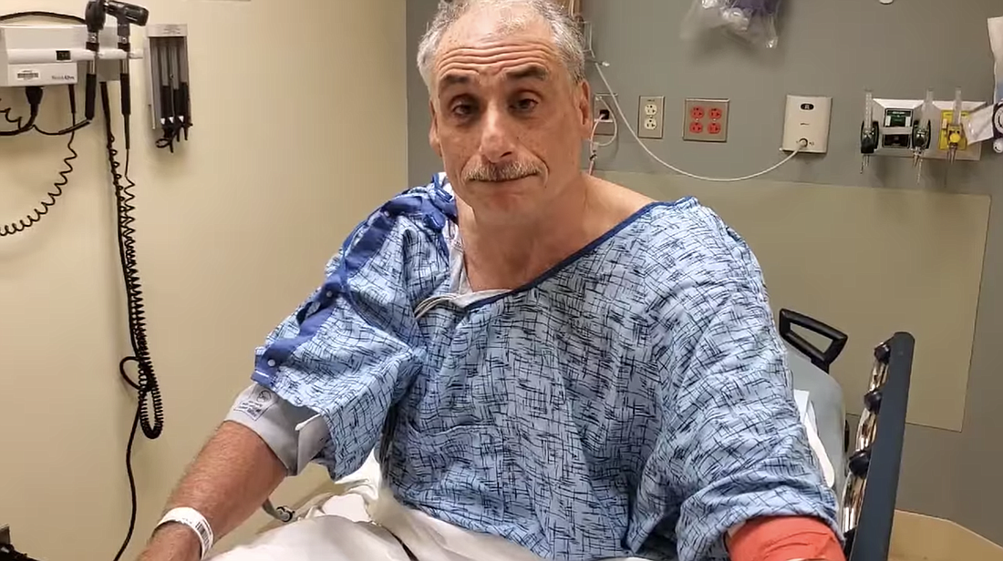 Sheriff Mike Chitwood was struck by a car for the second time while riding his bike on Thursday, March 18. Courtesy of Volusia Sheriff's Office Facebook