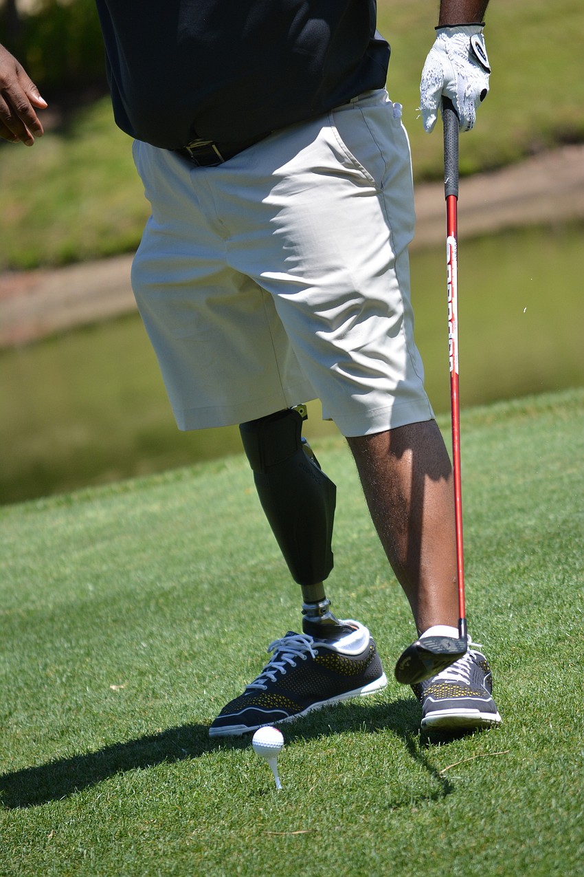 Army Staff Sgt. Christopher Gordon lost his right leg above the knee and has a permanent rod in his left leg after his infantry vehicle was hit by an improvised explosive device in Iraq.