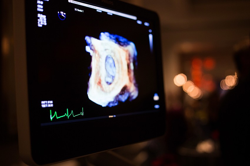 The paddle raise raised funds for cardiac equipment such as this cardiology ultrasound machine.