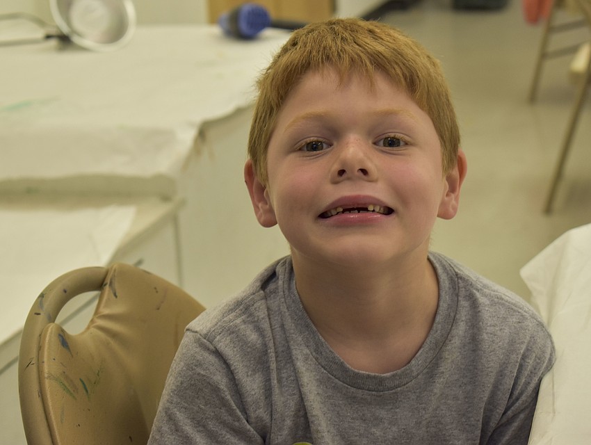 Jake Johnson shows off is missing teeth.