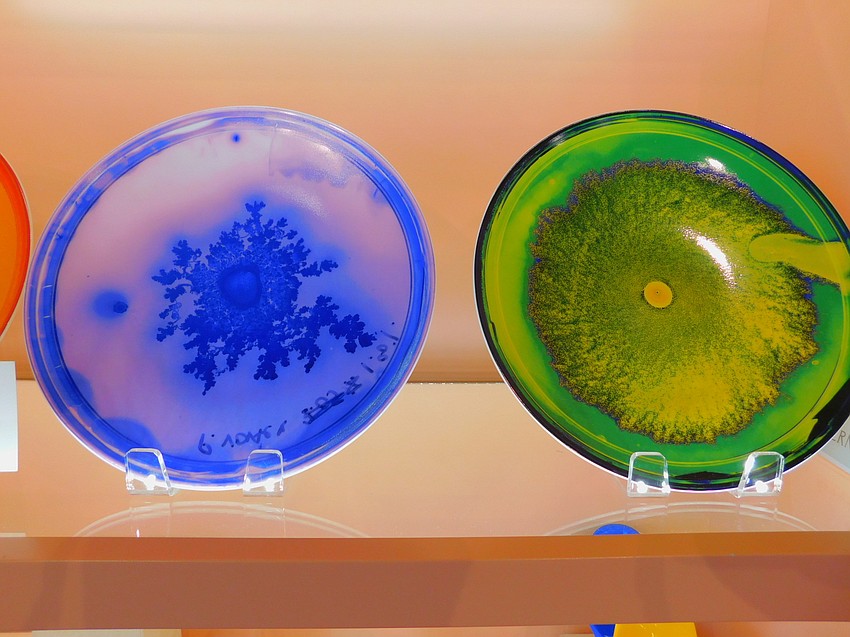 Decorative plates available for sale in the museum are based on Vik Muniz designs taken from blown-up images of deadly bacteria.