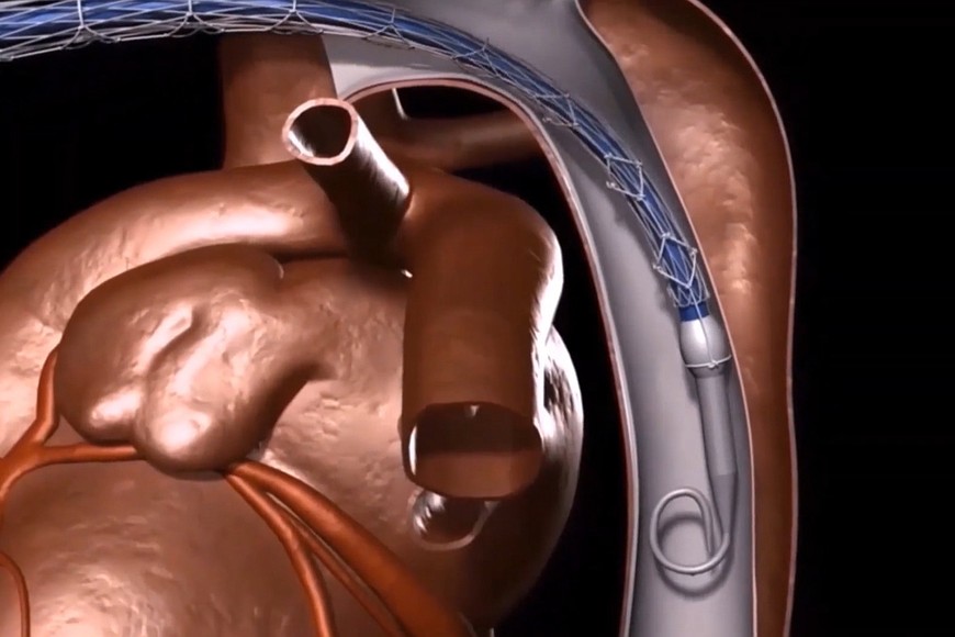 heart_animation_screen_grab_r8