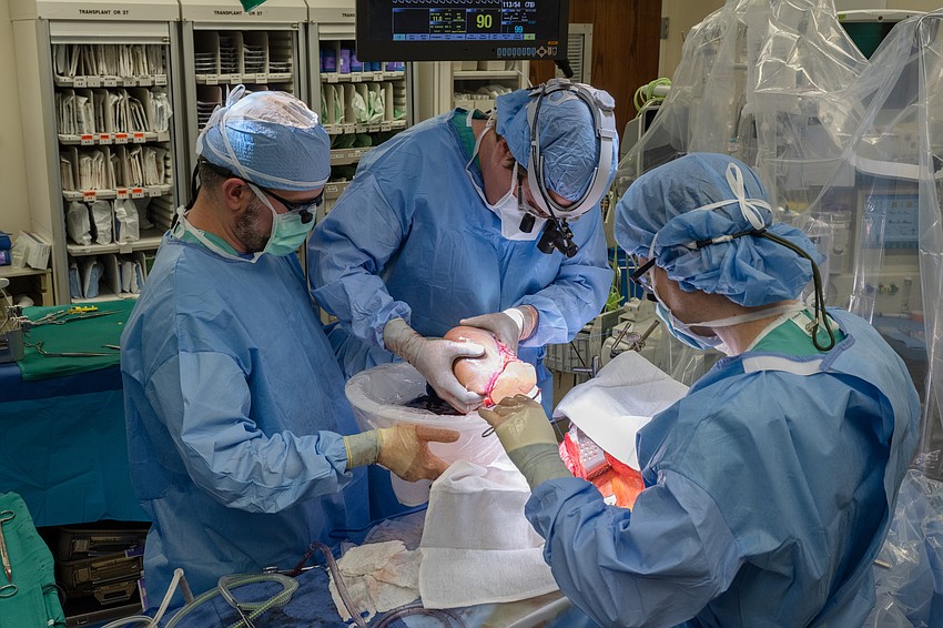 The team at Northwestern Medicine Comprehensive Transplant Center carefully worked with the liver.