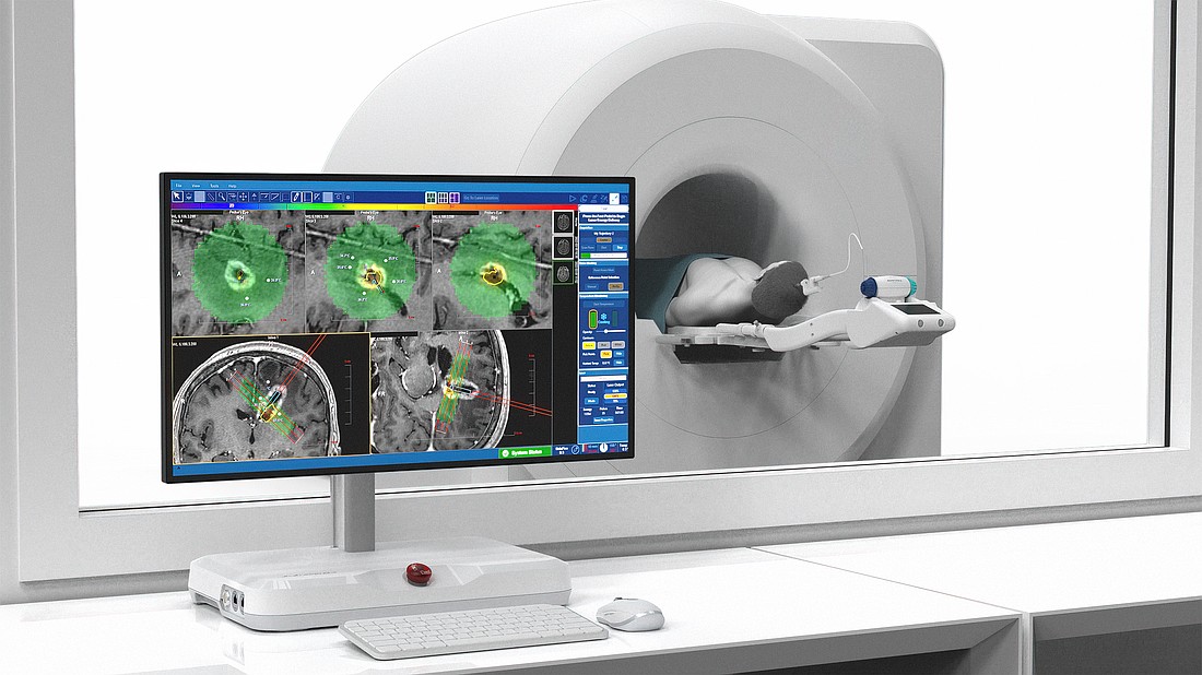 For laser interstitial thermal therapy, most of the work is done before the procedure when surgeons map out where to best attack a tumor with lasers to obtain the best access and achieve the desired results. The operation itself can take less than an hour. The technique is also a successful way to treat epilepsy.