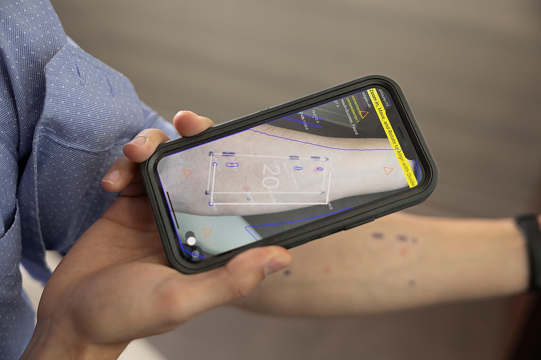 Researchers at Mayo Clinic in Florida are incorporating artificial intelligence and smartphone technology to diagnose allergies in what could be a simple at-home test.