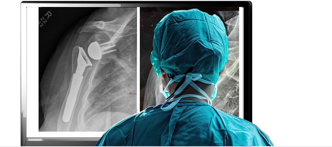 Catalyst OrthoScience was founded in 2014.