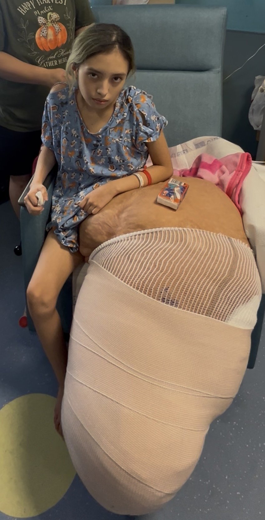 Jasmine Ramirez's leg began to grow at an abnormal rate when she was 2. Now 14, she had the leg amputated Dec. 11.